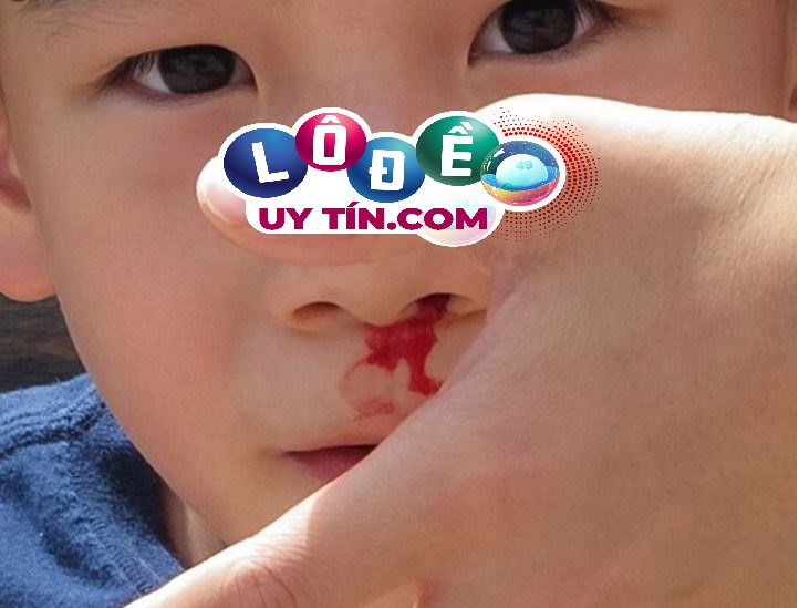 Mơ thấy chảy máu mũi, máu cam là điềm gì, đánh con gì?